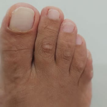 Pedikür Hizmetinde Hijyen Ve Özen Eksikliği