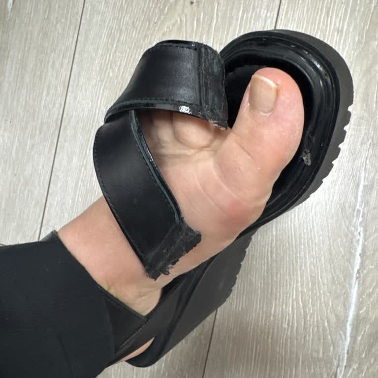 Garanti Süresi Dışında Bırakılan Kusurlu Sandalet İçin Değişim Talebim