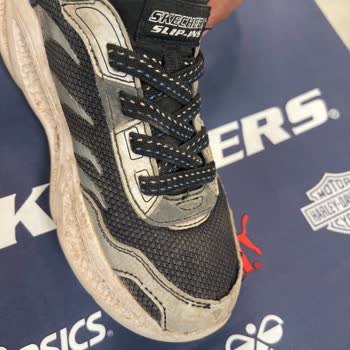 Skechers Kısa Sürede Dikişleri Patlayan Ayakkabılarda Değişim Reddi Şaşkınlığı
