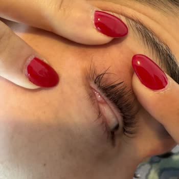 Miley Beauty Lounge İpek Kirpik İşlemi Yüzünden Korneamda Yara Oluştu