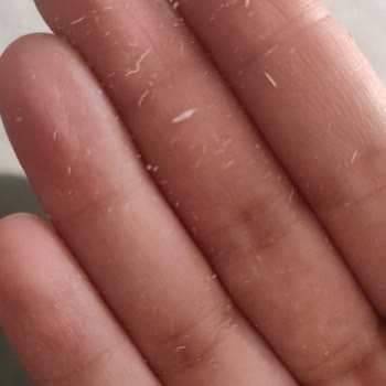 Bioderma Güneş Kremi Yüzümde Soyulma Ve Pul Pul Dökülme Yapıyor