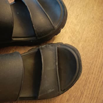 Güneşte Küçülen Sandalet İçin İade Reddedildi Mağaza Çözüm Sunmuyor