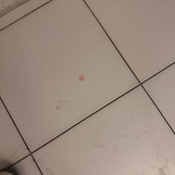 İlgisiz İletişim, Hijyen Eksikliği Ve Mahremiyet İhlaliyle Hayal Kırıklığı Yaşadım