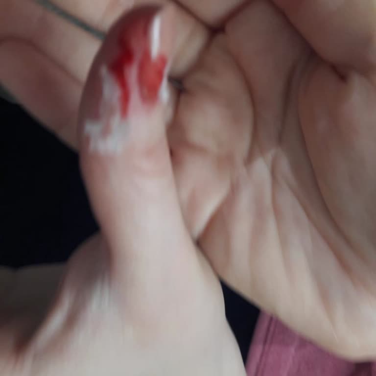 Konserve Kutusu Açılırken Elimi Kestim, Mağdur Oldum