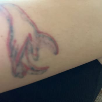 Babe Beauty Kolum Yandı Enfeksiyon Kaptı