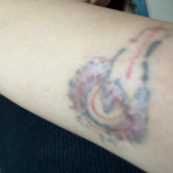 Babe Beauty Kolum Yandı Enfeksiyon Kaptı