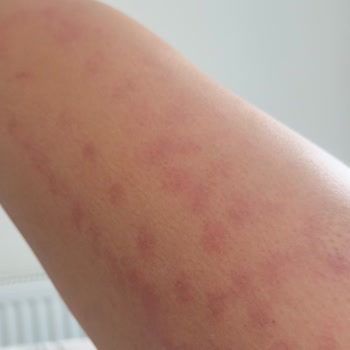 İş Bilmezlik Yüzünden Tekrar Mağdur Oldum