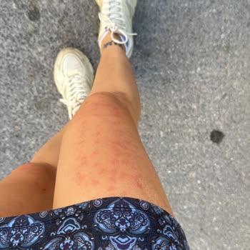 İş Bilmezlik Yüzünden Tekrar Mağdur Oldum