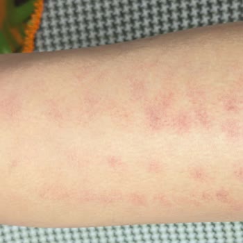 İş Bilmezlik Yüzünden Tekrar Mağdur Oldum