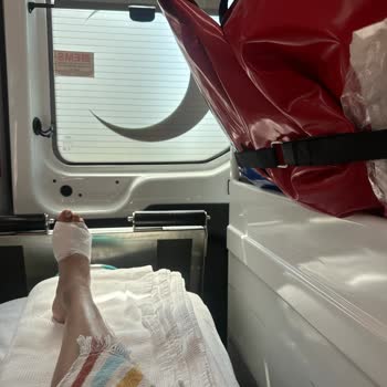 Novum Garden Side Hotel Havuzdaki İhmal Ayak Sağlığımdan Etti