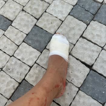 Novum Garden Side Hotel Havuzdaki İhmal Ayak Sağlığımdan Etti