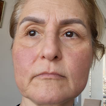 La Roche - Posay  Cildimi Mahveden Serum