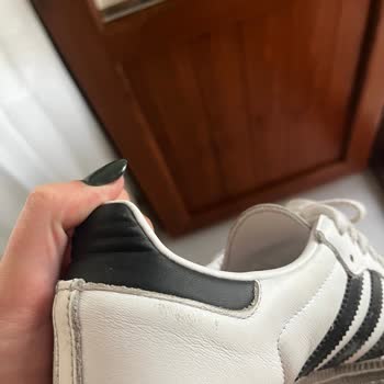 Akasya SuperStep'ten Aldığım Adidas Ayakkabının Derisi Hızla Soyuldu, Yetkililerden Dönüş Alamadım