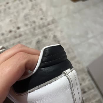 Akasya SuperStep'ten Aldığım Adidas Ayakkabının Derisi Hızla Soyuldu, Yetkililerden Dönüş Alamadım