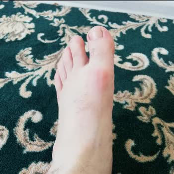 Reebok Ayakkabıda Vurma Sorunu Ve Değişim Reddi