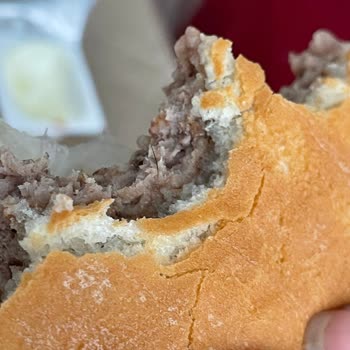 Siparişte Çıkan Kıl Ve Müşteri Hizmetleri Mağduriyeti