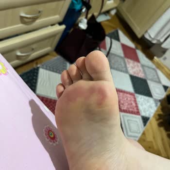 Elle Ayakkabıda Yaşadığım Sorun Ve Müşteri Hizmetleri Hayal Kırıklığı