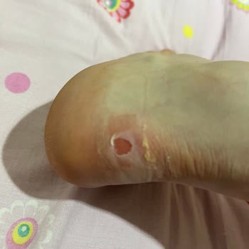 Elle Ayakkabıda Yaşadığım Sorun Ve Müşteri Hizmetleri Hayal Kırıklığı