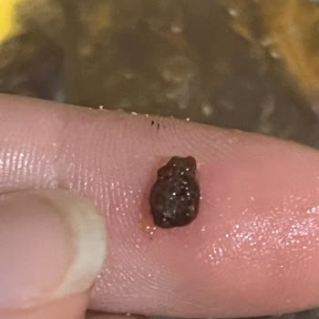 Cips İçerisinde Sert Ve Yabancı Madde Tehlikesi