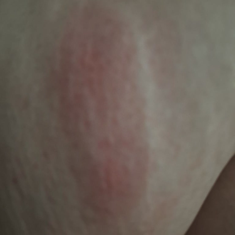 Güler Apart (Arsuz) Böceklerle Dolu Oda ve Saygısızlık