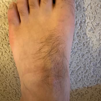 Elle Ayakkabı Mağazasından Alınan Ayakkabı Sağlığımı Olumsuz Etkiledi, Çözüm Sunulmadı