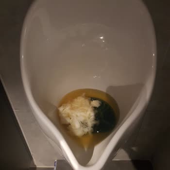 Kadıköy Burger King Rıhtım Şubesinde Hijyen Ve Personel Sorunu