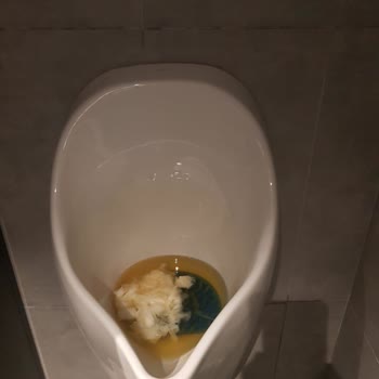 Kadıköy Burger King Rıhtım Şubesinde Hijyen Ve Personel Sorunu