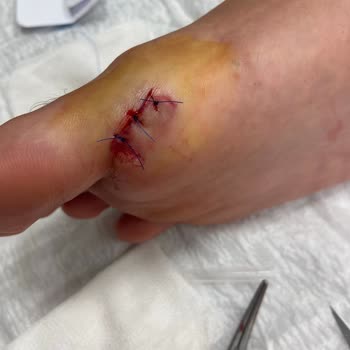 Lion Aquapark (Sakarya) Personelinin İhmali