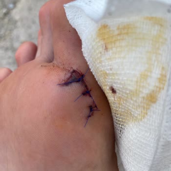 Lion Aquapark (Sakarya) Personelinin İhmali