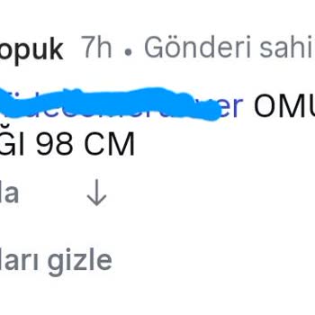 İnce Topuk Yıkama Sonrası Üründe Aşırı Çekme Ve Firma İlgisizliği