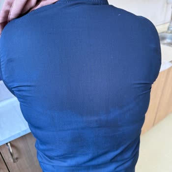 Kumaş Hatası Nedeniyle Lekelenen Ürüne Çözüm Sunulmadı