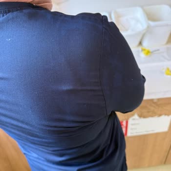 Kumaş Hatası Nedeniyle Lekelenen Ürüne Çözüm Sunulmadı