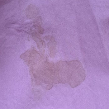 Aldığım Elbisede Kan Lekesi Çıktı İade Kabul Edilmedi