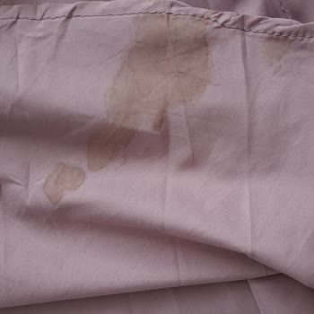 Aldığım Elbisede Kan Lekesi Çıktı İade Kabul Edilmedi