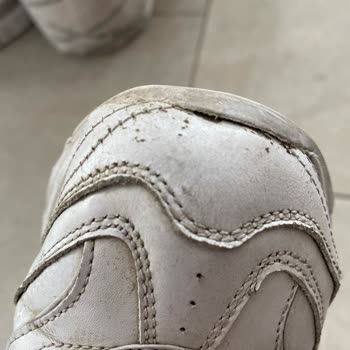 Skechers Ayakkabının Hızla Deforme Olması Ve Kalite Sorunu