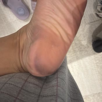 Satın Aldığım Ayakkabı Ayağımı Boyadı Ve Kalitesiz Çıktı