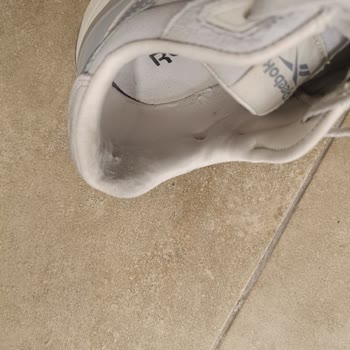 3 Ayda Yırtılan Ayakkabı İçin Haksız Kullanıcı Hatası İddiası