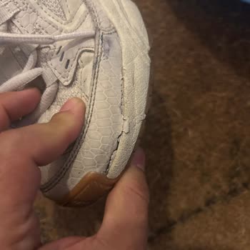 Skechers Ayakkabıda Erken Açılma Ve Kusur Reddi Mağduriyeti