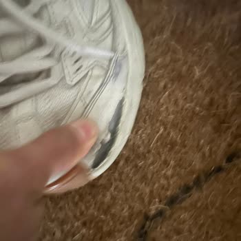 Skechers Ayakkabıda Erken Açılma Ve Kusur Reddi Mağduriyeti