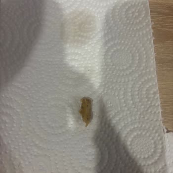 Aldığım Üründen Mısır Koçanı Çıktı, Hijyen Ve Güven Sarsıldı