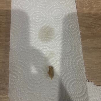 Aldığım Üründen Mısır Koçanı Çıktı, Hijyen Ve Güven Sarsıldı