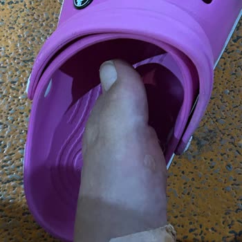 Derimod Sandalet Ayaklarımı Mahvetti Mağaza Çözüm Sunmuyor