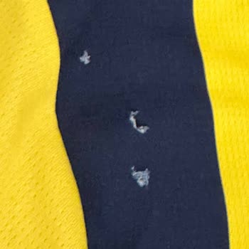 Aldığım Formada Yırtık Çıktı İade Ve Değişim Reddedildi