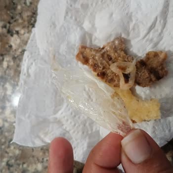 I Found a Piece of Plastic in My Daughter's Burger at Burger King