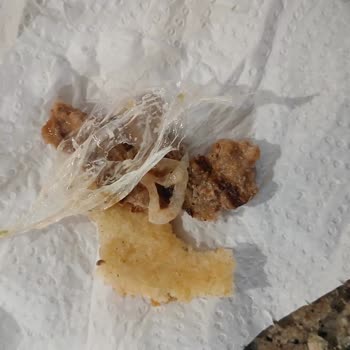 I Found a Piece of Plastic in My Daughter's Burger at Burger King