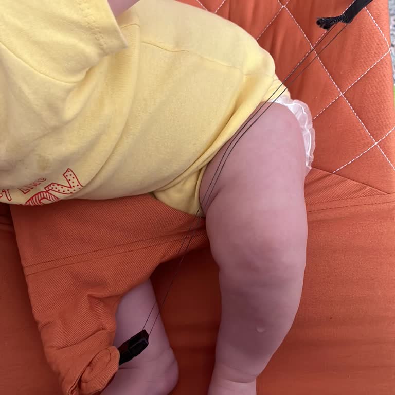 Pierre Cardin Ana Kucağı Kilidi Koptu, Güvenlik Riski Oluştu