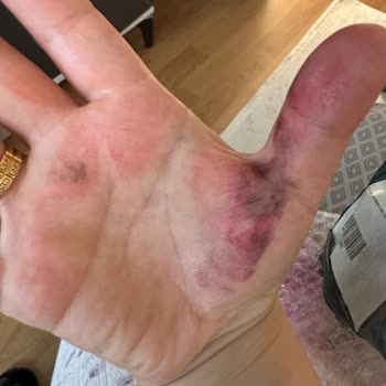 Kırık Ürün Ve Hasarlı Kutu Nedeniyle İade Sorunu