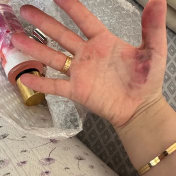 Kırık Ürün Ve Hasarlı Kutu Nedeniyle İade Sorunu