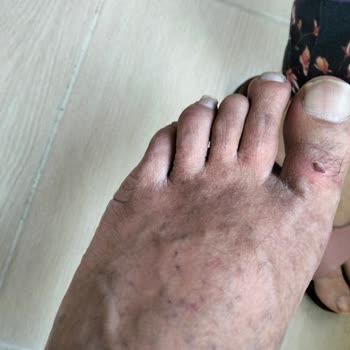 Bir Kez Giyilen Terlik Ayağı Kesti Mağduriyet Yaşadık