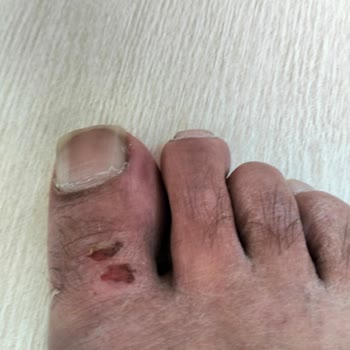 Bir Kez Giyilen Terlik Ayağı Kesti Mağduriyet Yaşadık